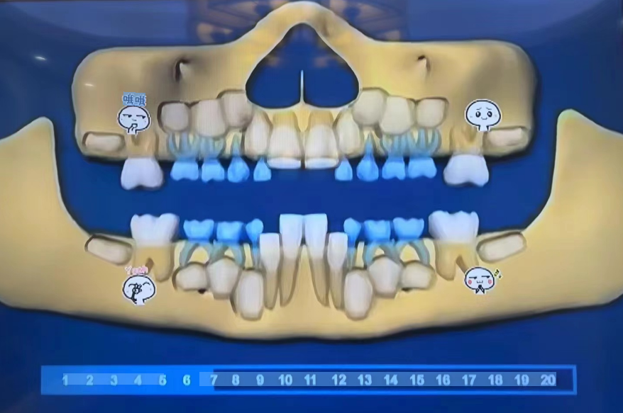 Can children with missing teeth use electric toothbrushes?